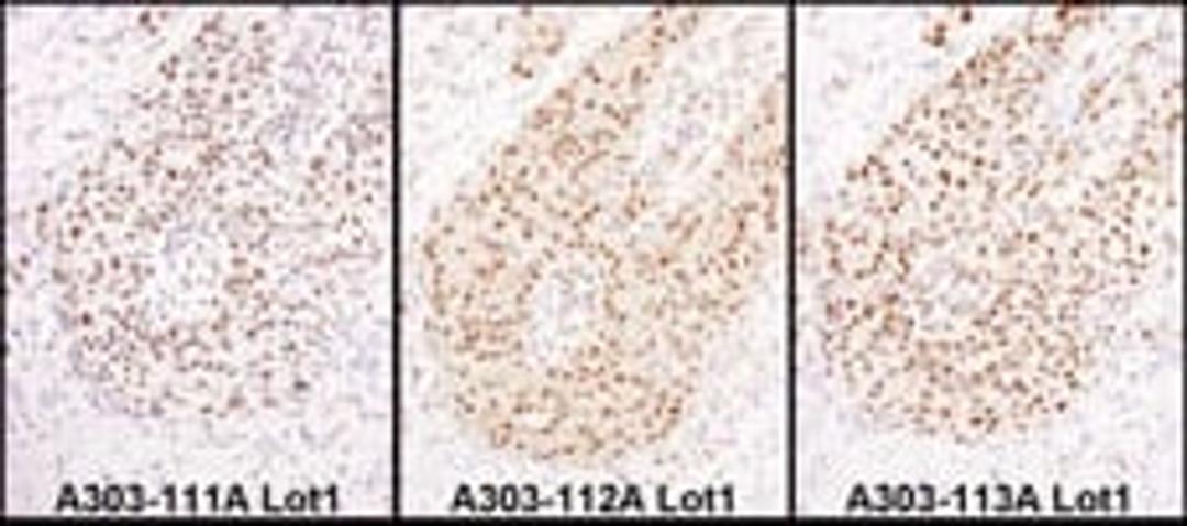 Detection of human HEXIM1 by immunohistochemistry.