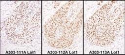 Detection of human HEXIM1 by immunohistochemistry.