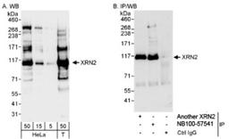 Western Blot: XRN2 Antibody [NB100-57541] - Whole cell lysate from HeLa (5, 15 and 50 mcg for WB; 1 mg for IP, 20% of IP loaded) and 293T (T; 50 mcg) cells.Affinity purified rabbit anti-XRN2 antibody used for WB at 0.04 mcg/ml (A) and 1 mcg/ml (B) and used for IP at 3 mcg/mg lysate. XRN2 was also immunoprecipitated by rabbit anti-XRN2 antibody, which recognizes an upstream epitope. Detection: Chemiluminescence with exposure times of 3 seconds (A) and 10 seconds (B).