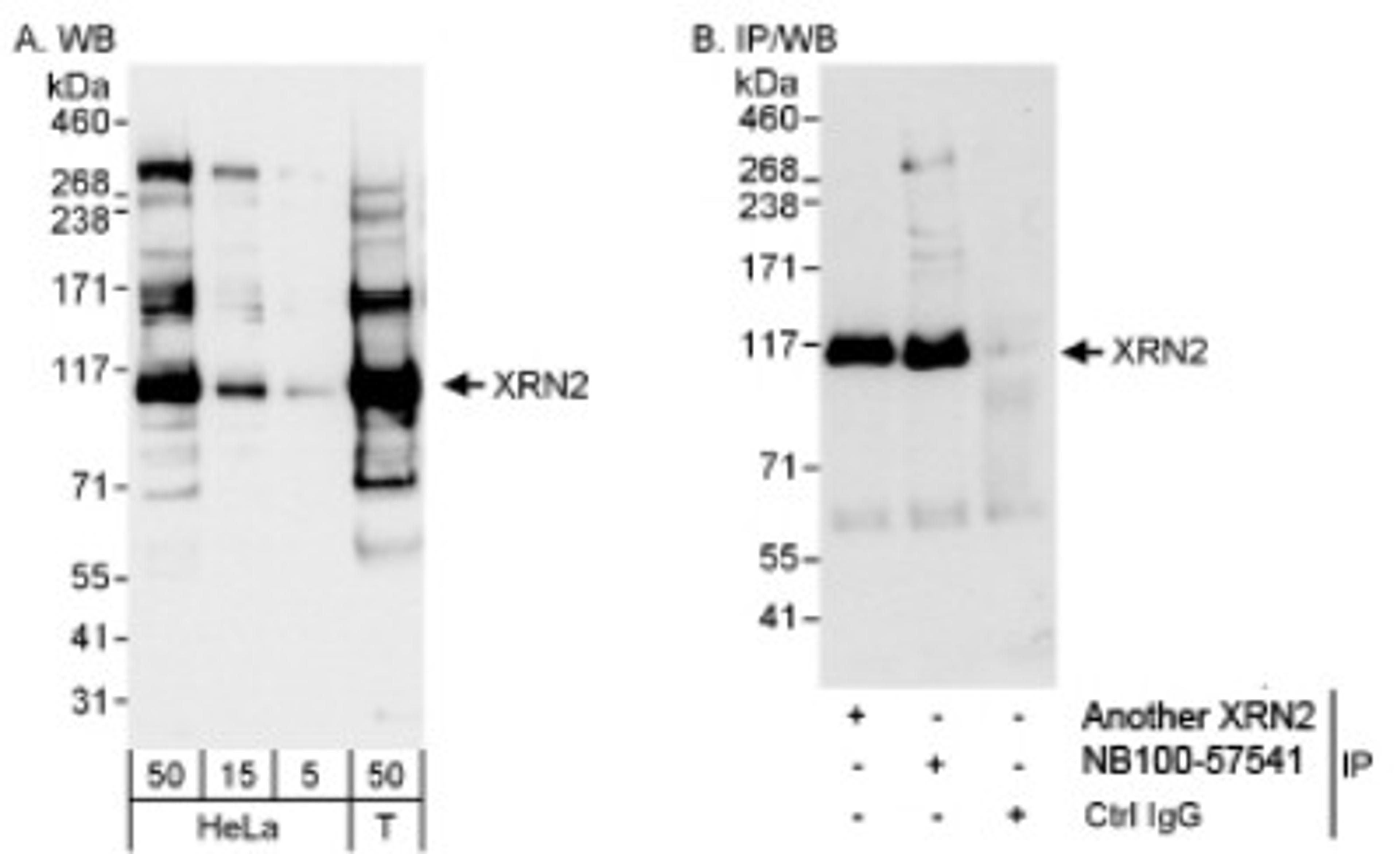 Western Blot: XRN2 Antibody [NB100-57541] - Whole cell lysate from HeLa (5, 15 and 50 mcg for WB; 1 mg for IP, 20% of IP loaded) and 293T (T; 50 mcg) cells.Affinity purified rabbit anti-XRN2 antibody used for WB at 0.04 mcg/ml (A) and 1 mcg/ml (B) and used for IP at 3 mcg/mg lysate. XRN2 was also immunoprecipitated by rabbit anti-XRN2 antibody, which recognizes an upstream epitope. Detection: Chemiluminescence with exposure times of 3 seconds (A) and 10 seconds (B).