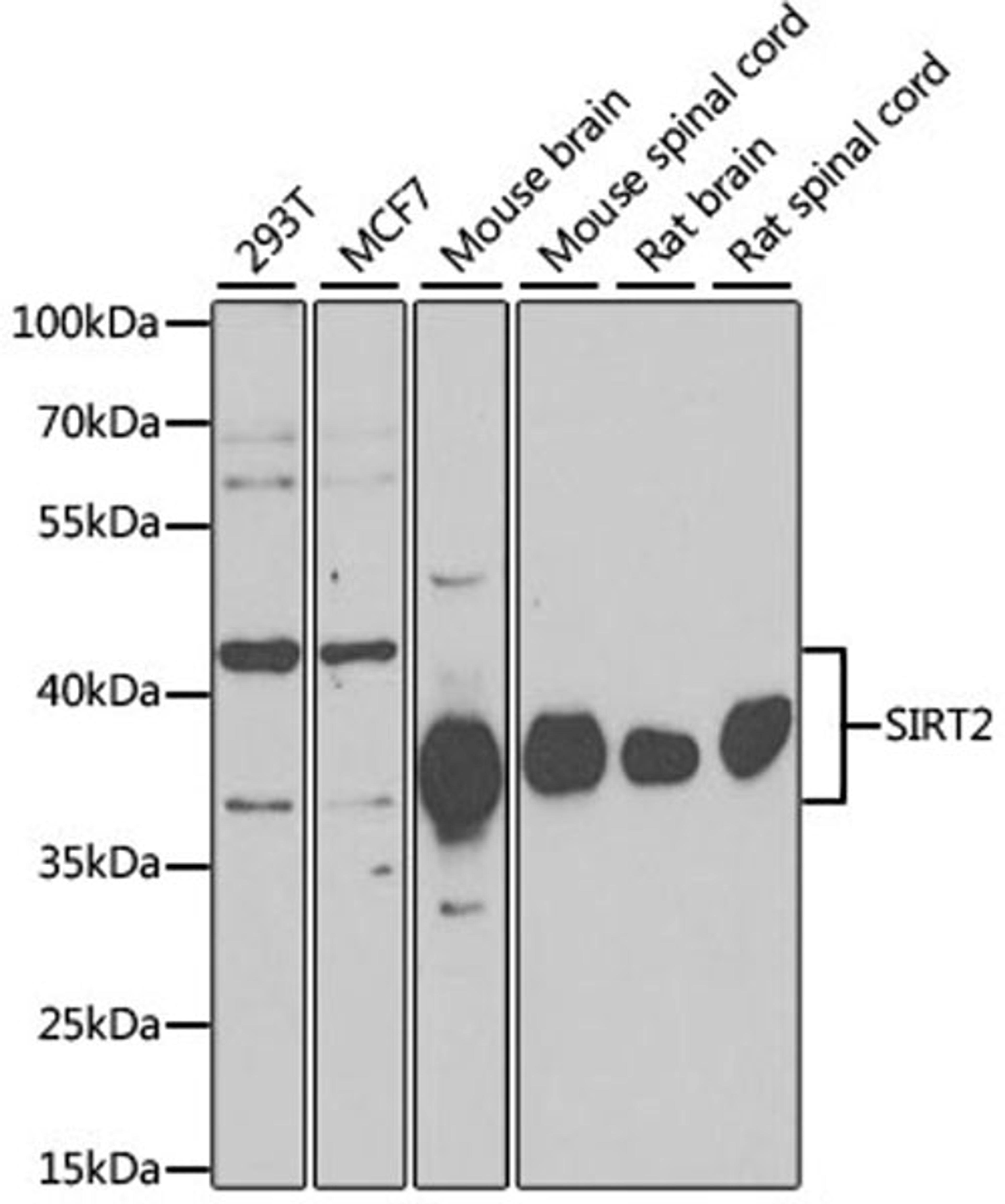 Western blot - SIRT2 antibody (A12575)