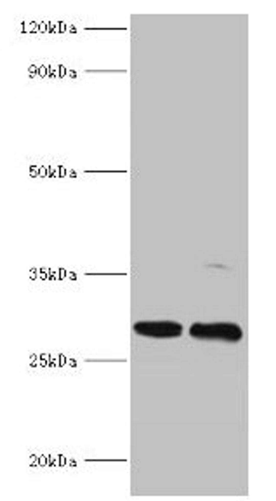 Western blot. All lanes: PIGX antibody at 2µg/ml. Lane 1: Mouse kidney tissue. Lane 2: 293T whole cell lysate. Secondary. Goat polyclonal to rabbit IgG at 1/10000 dilution. Predicted band size: 29, 31 kDa. Observed band size: 29 kDa