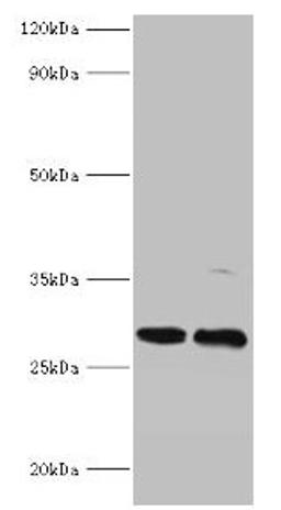 Western blot. All lanes: PIGX antibody at 2µg/ml. Lane 1: Mouse kidney tissue. Lane 2: 293T whole cell lysate. Secondary. Goat polyclonal to rabbit IgG at 1/10000 dilution. Predicted band size: 29, 31 kDa. Observed band size: 29 kDa