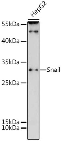 Western blot - Snail antibody (A12301)