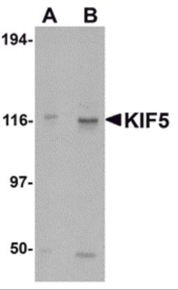 Western blot analysis of KIF5 in K562 cell lysate with KIF5 antibody at (A) 0.5 and (B) 1 &#956;g/mL.