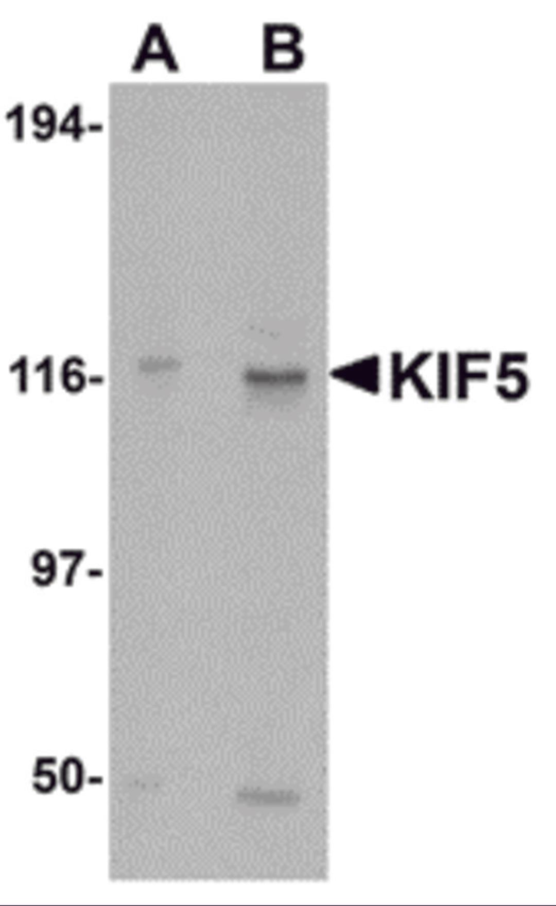 Western blot analysis of KIF5 in K562 cell lysate with KIF5 antibody at (A) 0.5 and (B) 1 μg/mL.