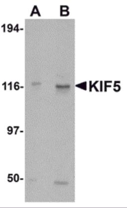 Western blot analysis of KIF5 in K562 cell lysate with KIF5 antibody at (A) 0.5 and (B) 1 μg/mL.