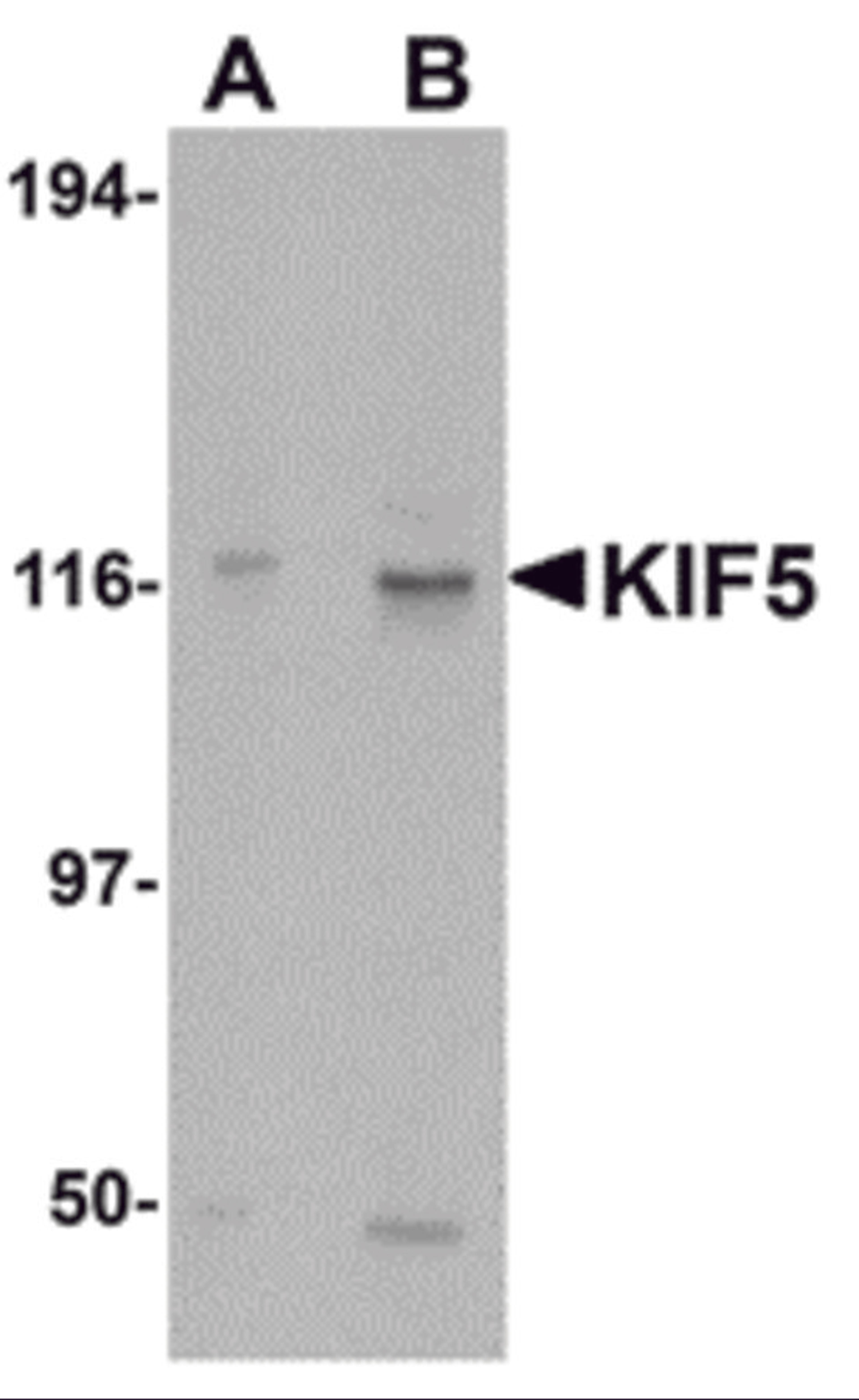 Western blot analysis of KIF5 in K562 cell lysate with KIF5 antibody at (A) 0.5 and (B) 1 μg/mL.