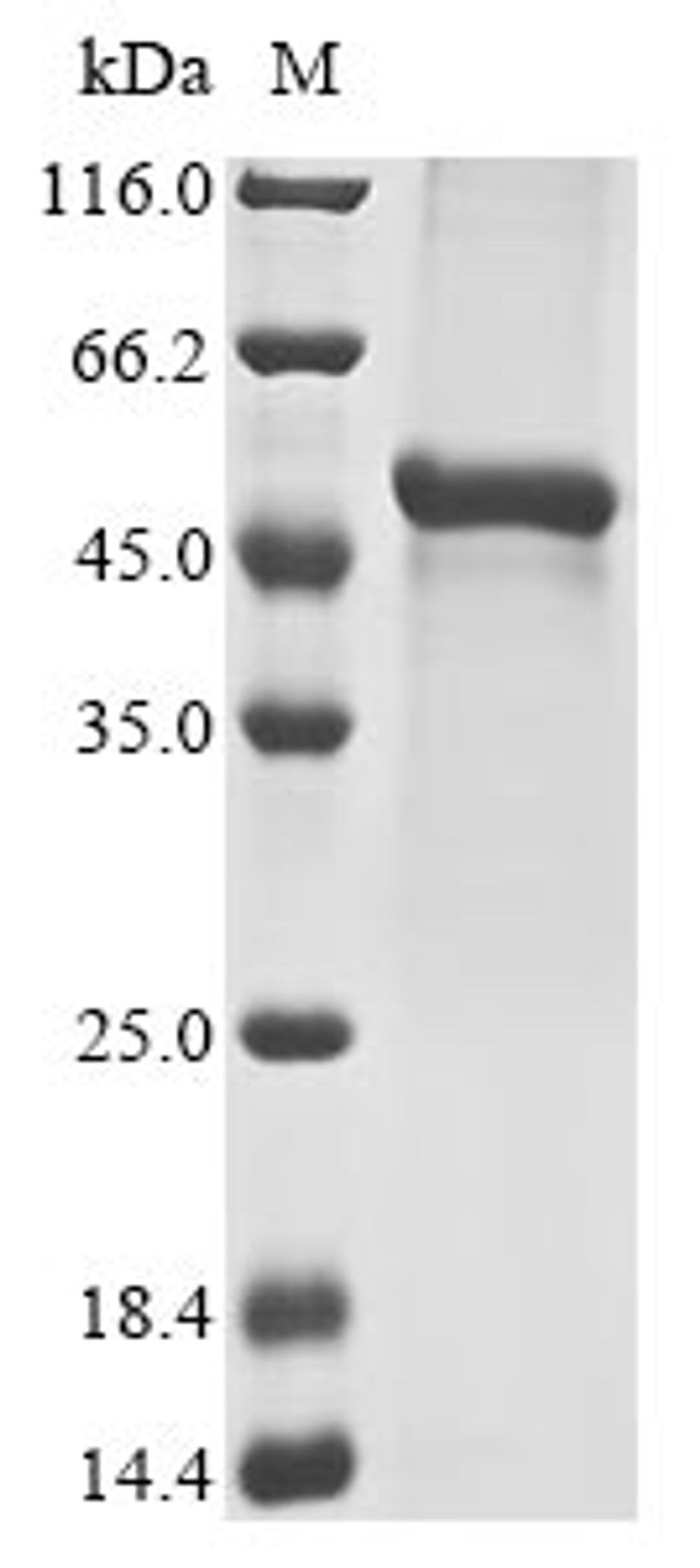 (Tris-Glycine gel) Discontinuous SDS-PAGE (reduced) with 5% enrichment gel and 15% separation gel.