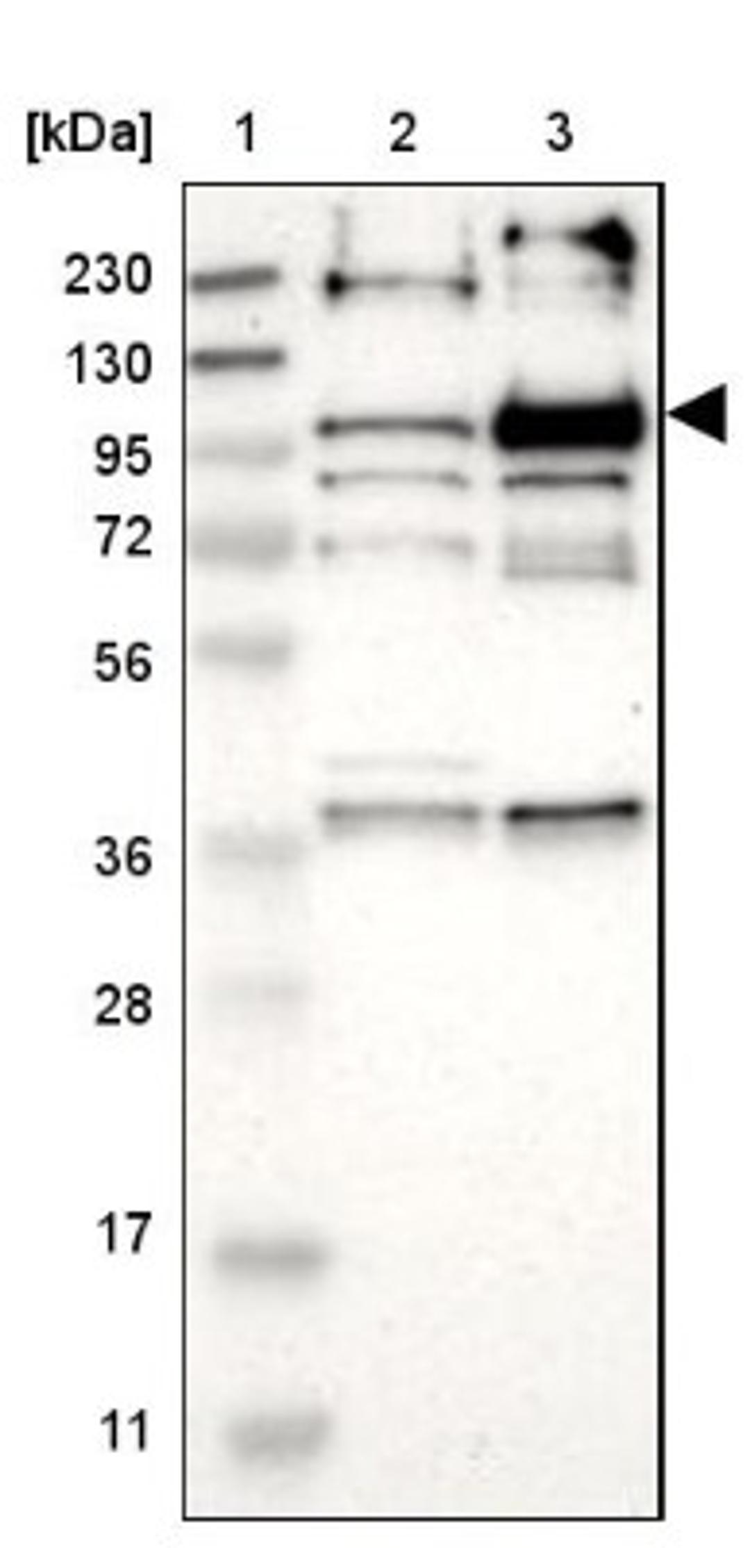 Western Blot: LRCH2 Antibody [NBP1-93588] - Lane 1: Marker [kDa] 230, 130, 95, 72, 56, 36, 28, 17, 11<br/>Lane 2: Human cell line RT-4<br/>Lane 3: Human cell line U-251MG sp