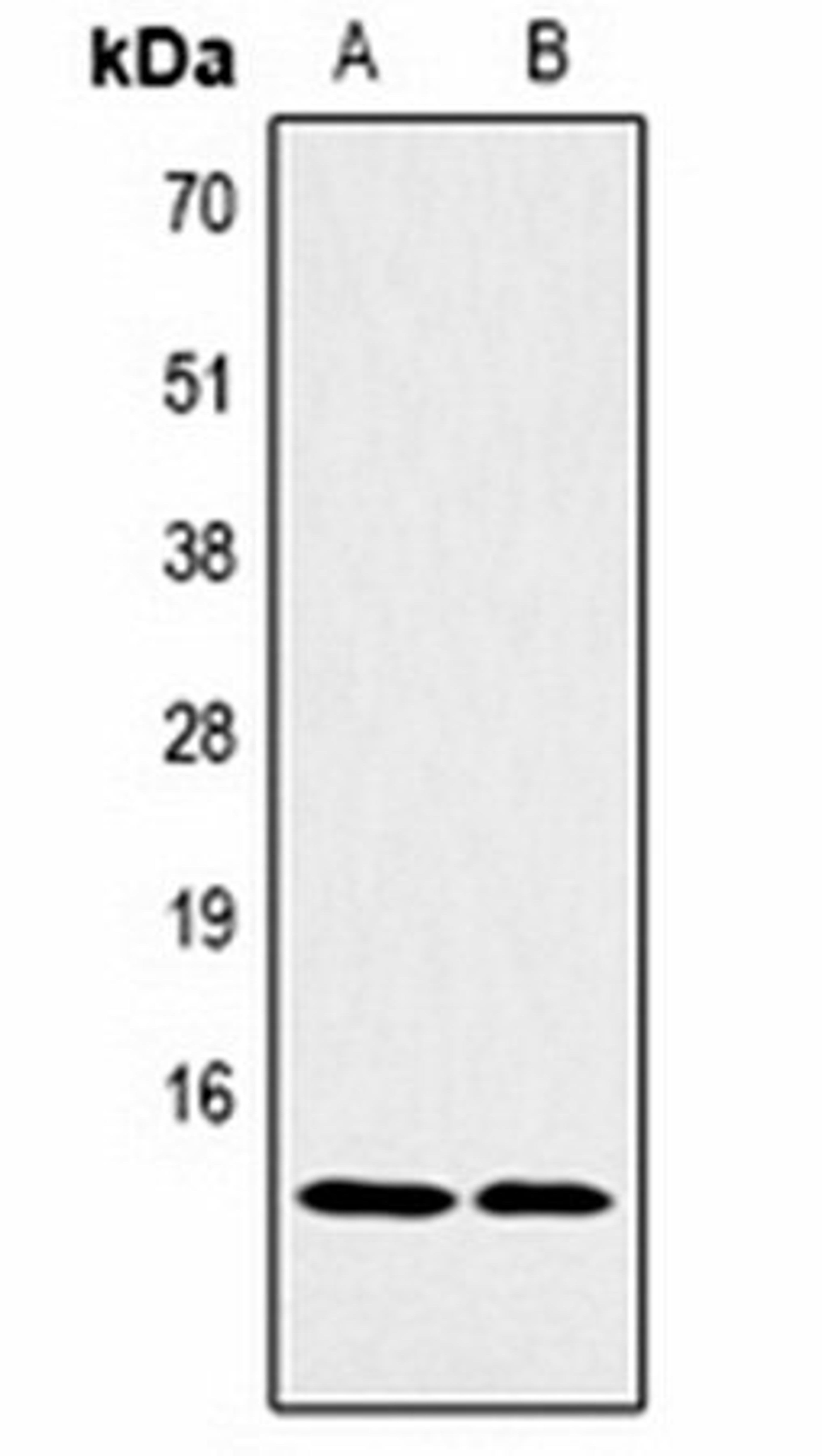 Western blot analysis of Hela (Lane1), NIH3T3 (Lane2) whole cell lysates using Histone H2B (MonoMethyl K5) antibody
