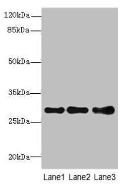 Western blot. All lanes: STX7antibody at 1.39ug/ml. Lane 1: Mouse spleen tissue. Lane 2: Hela whole cell lysate. Lane 3: HepG2 whole cell lysate. Secondary. Goat polyclonal to rabbit IgG at 1/10000 dilution. Predicted band size: 30, 28 kDa. Observed band size: 30 kDa. 