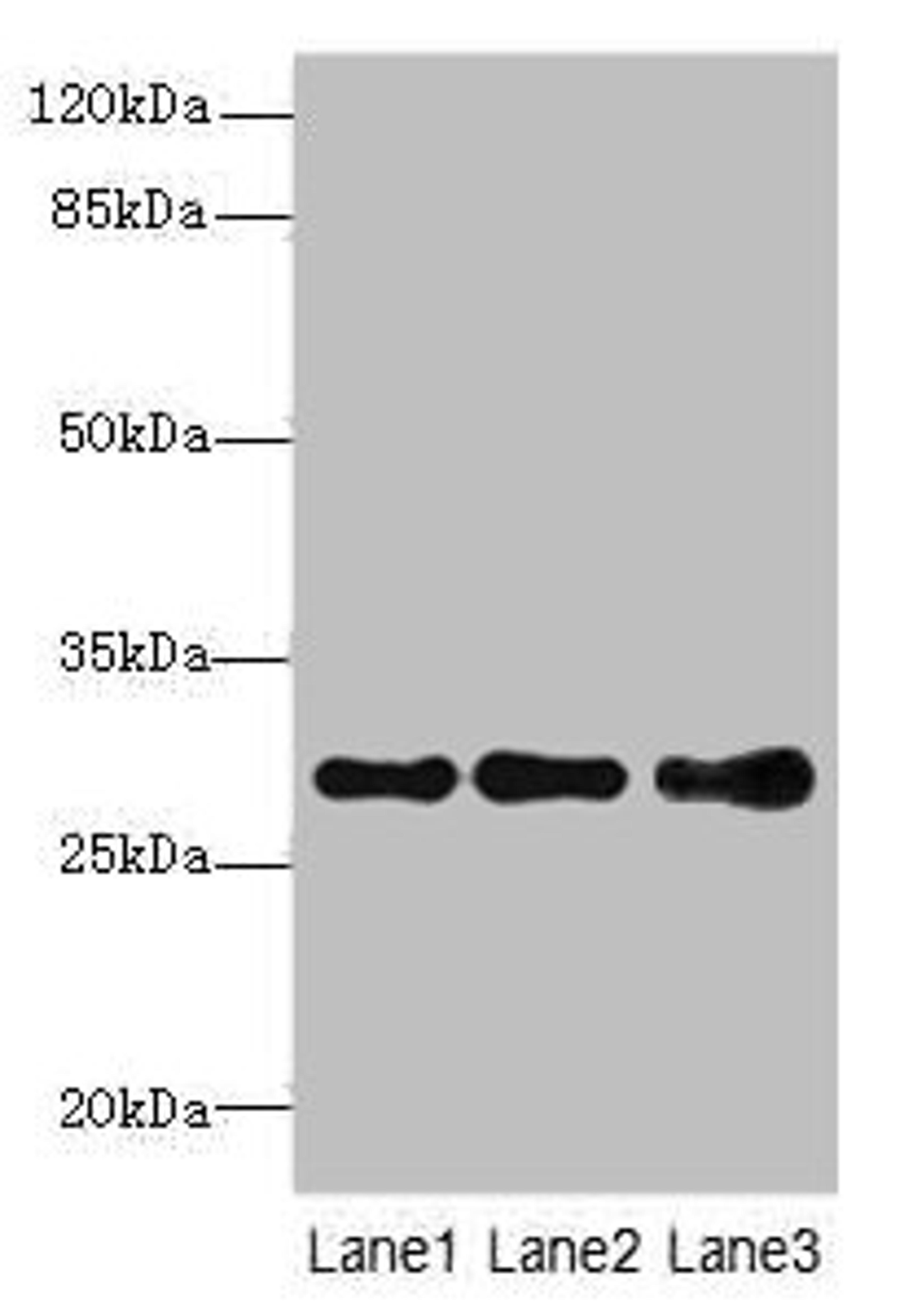 Western blot. All lanes: STX7antibody at 1.39ug/ml. Lane 1: Mouse spleen tissue. Lane 2: Hela whole cell lysate. Lane 3: HepG2 whole cell lysate. Secondary. Goat polyclonal to rabbit IgG at 1/10000 dilution. Predicted band size: 30, 28 kDa. Observed band size: 30 kDa. 