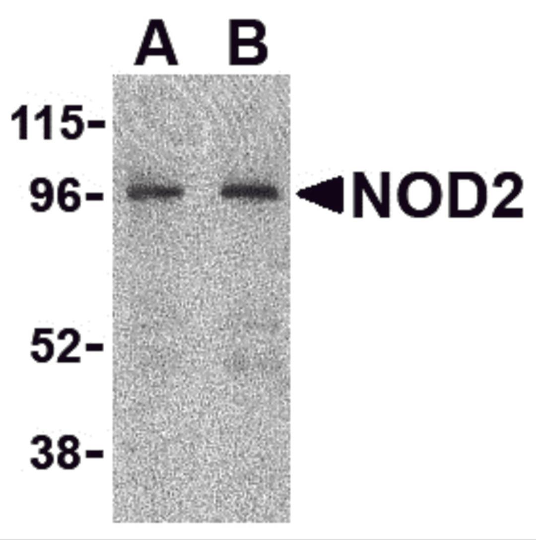 Western blot analysis of NOD2 in HeLa cell lysate with NOD2 antibody at (A) 2 and (B) 4 &#956;g/mL.