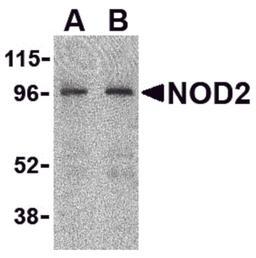 Western blot analysis of NOD2 in HeLa cell lysate with NOD2 antibody at (A) 2 and (B) 4 μg/mL.