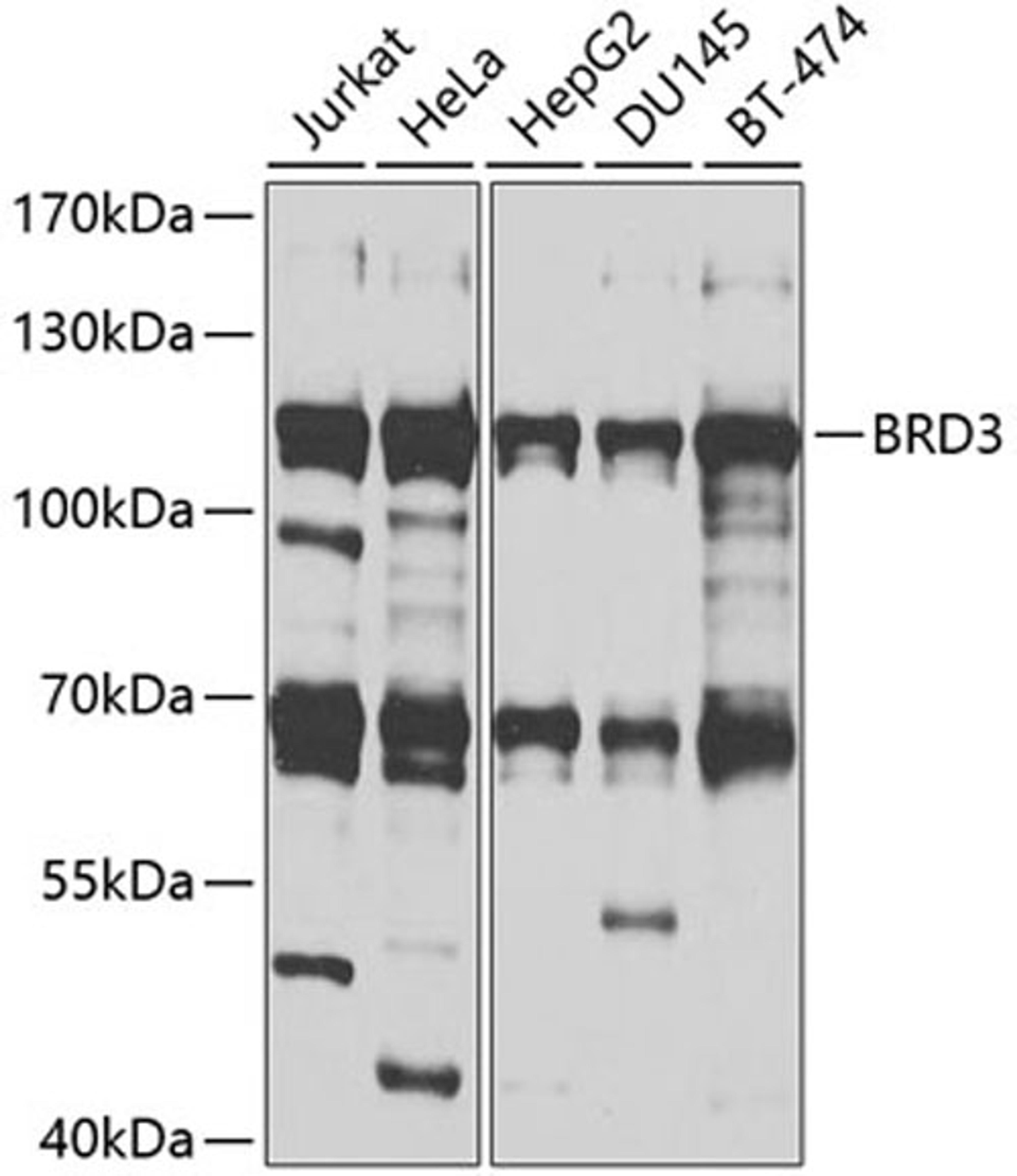 Western blot - BRD3 antibody (A2277)