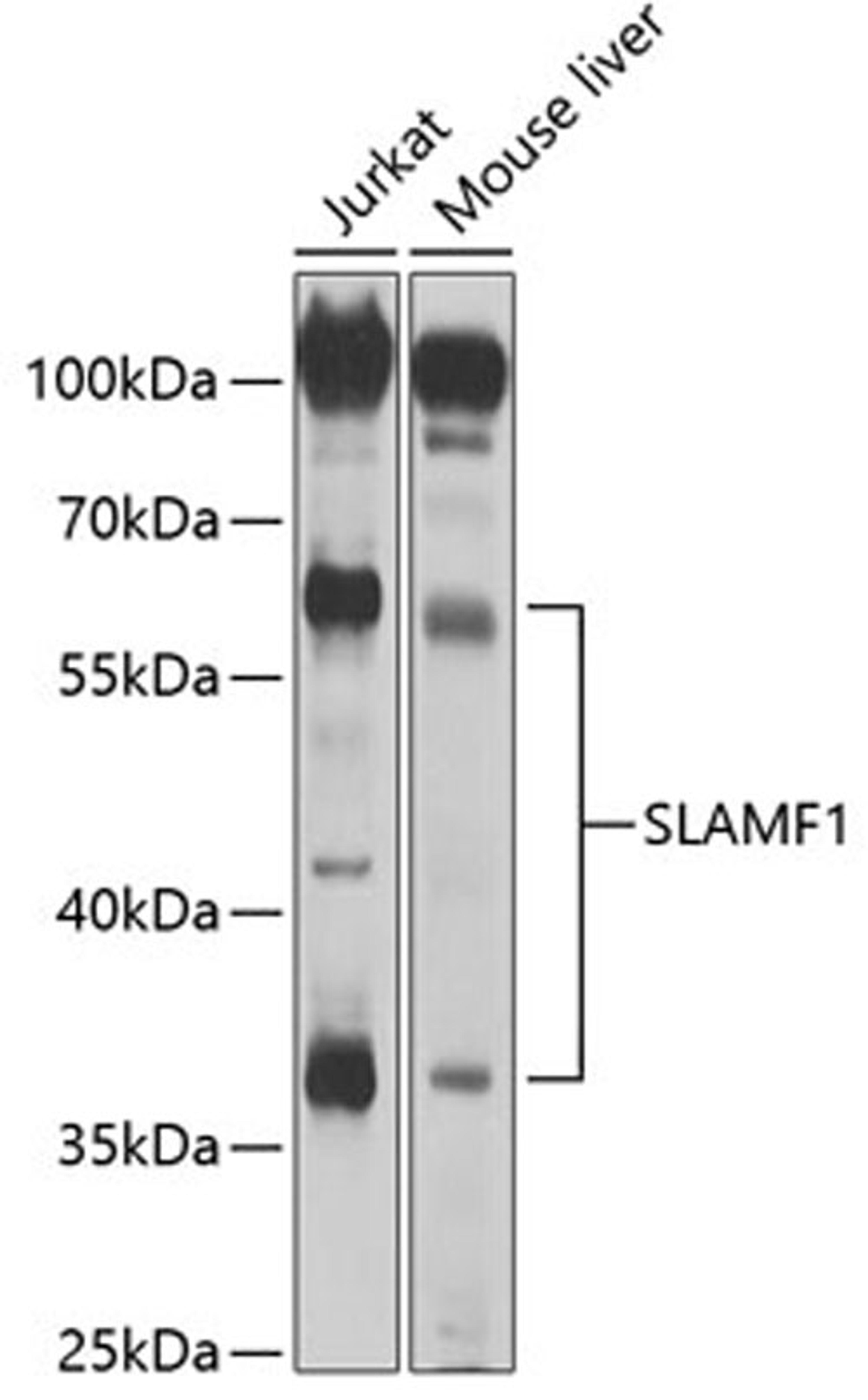 Western blot - SLAMF1 antibody (A2044)