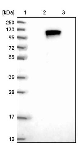 Western Blot: TLK1 Antibody [NBP1-83035] - Lane 1: Marker [kDa] 250, 130, 95, 72, 55, 36, 28, 17, 10<br/>Lane 2: Negative control (vector only transfected HEK293T lysate)<br/>Lane 3: Over-expression lysate (Co-expressed with a C-terminal myc-DDK tag (~3.1 kDa) in mammalian HEK293T cells, LY402184)