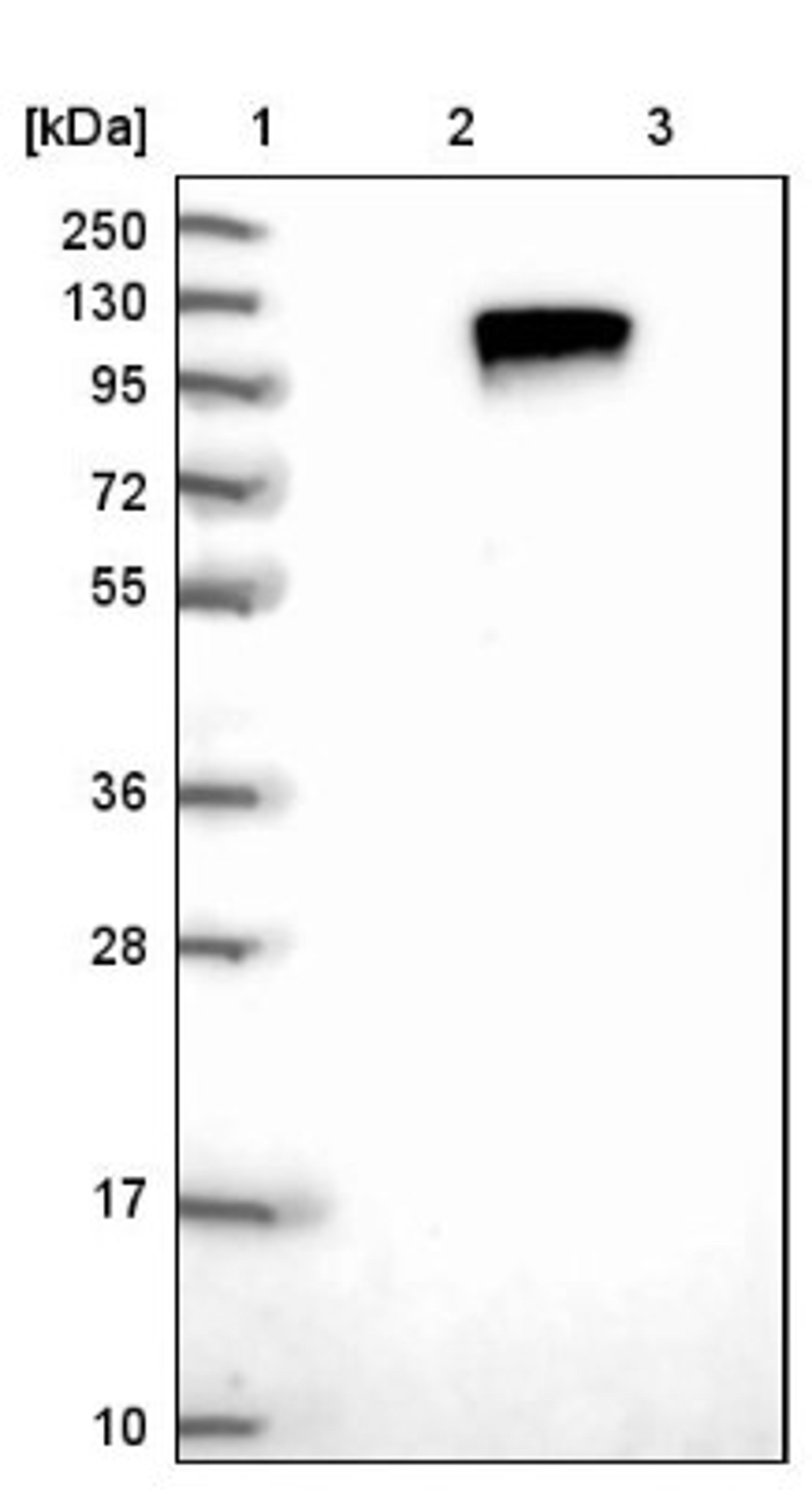 Western Blot: TLK1 Antibody [NBP1-83035] - Lane 1: Marker [kDa] 250, 130, 95, 72, 55, 36, 28, 17, 10<br/>Lane 2: Negative control (vector only transfected HEK293T lysate)<br/>Lane 3: Over-expression lysate (Co-expressed with a C-terminal myc-DDK tag (~3.1 kDa) in mammalian HEK293T cells, LY402184)