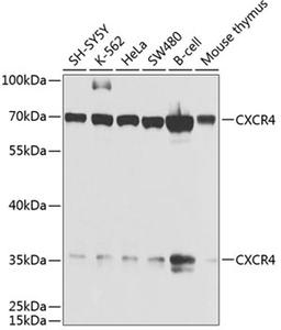 Western blot - CXCR4 antibody (A1303)