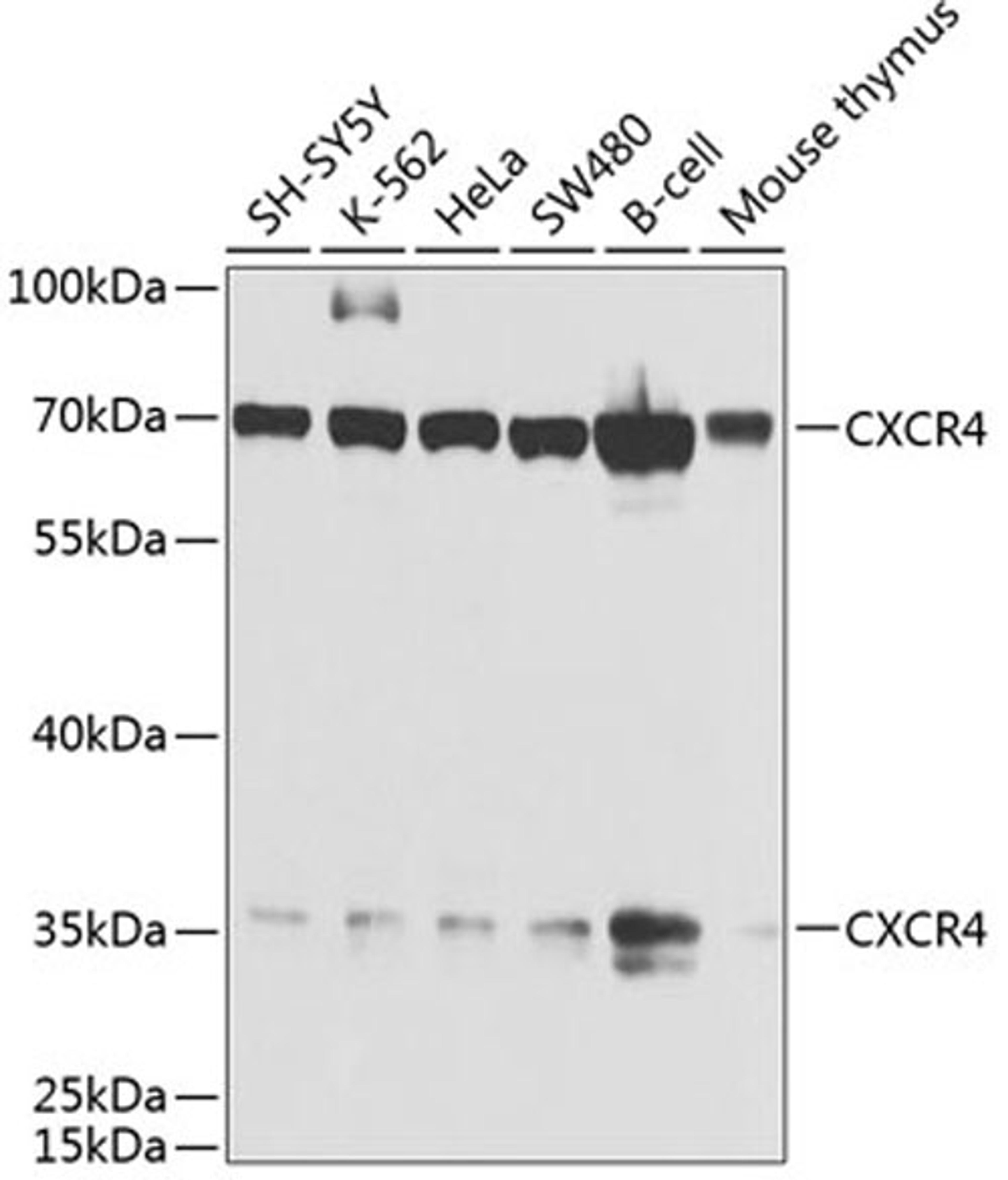 Western blot - CXCR4 antibody (A1303)