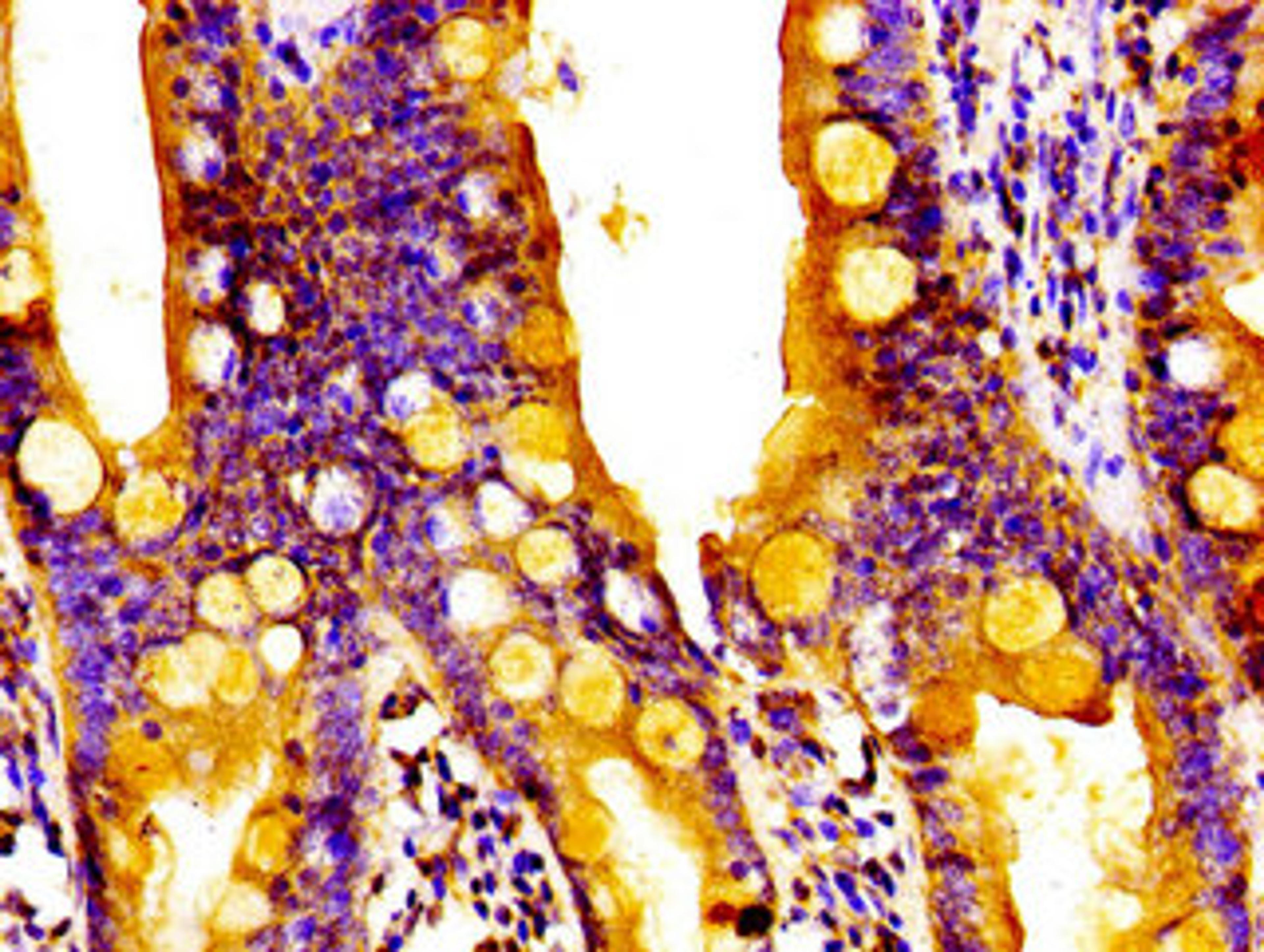 Immunohistochemistry of paraffin-embedded human small intestine tissue using CSB-PA019641LA01HU at dilution of 1:100