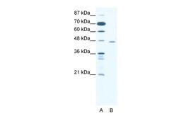 Antibody used in WB on Human Jurkat cells at 1.25 ug/ml.