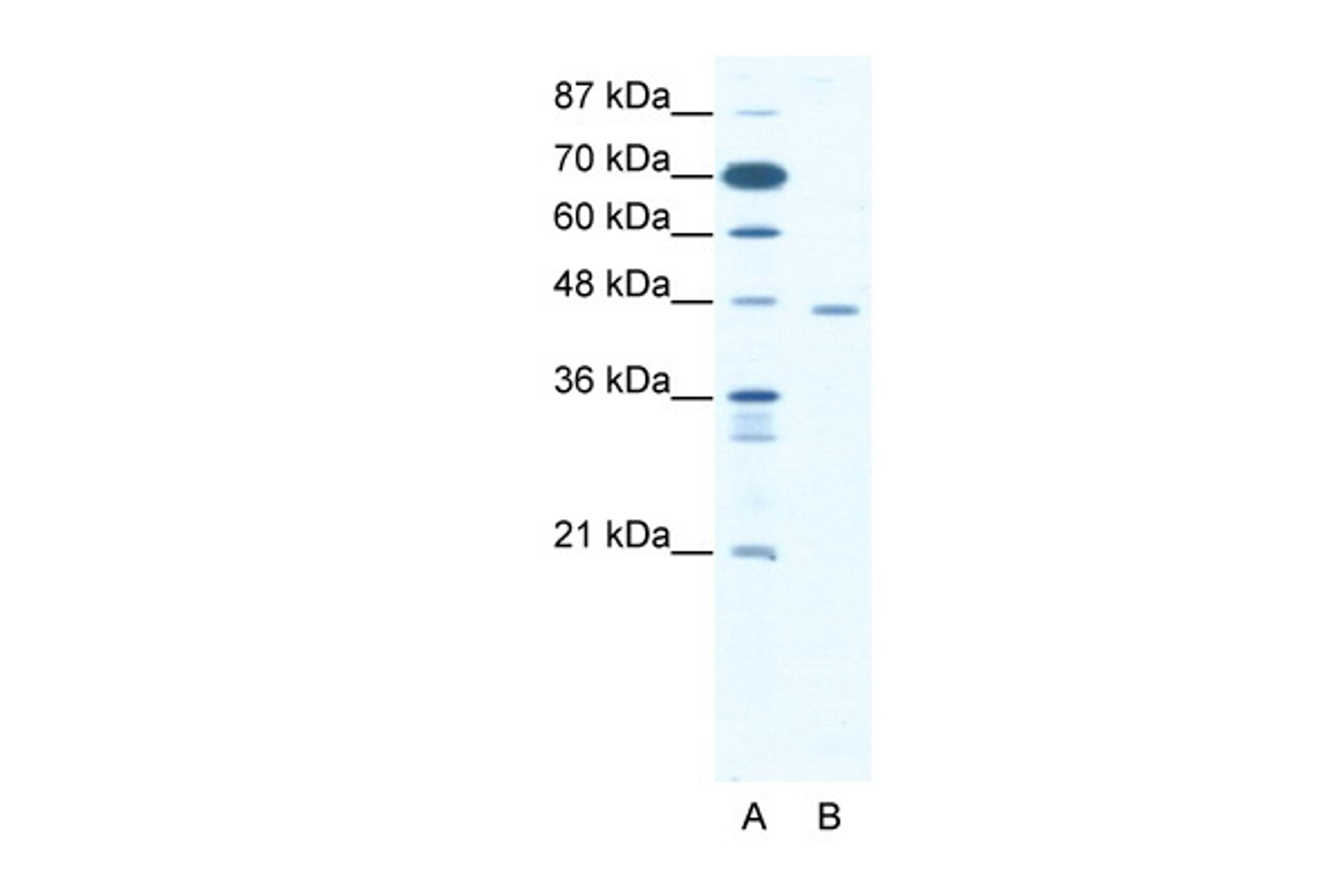 Antibody used in WB on Human Jurkat cells at 1.25 ug/ml.