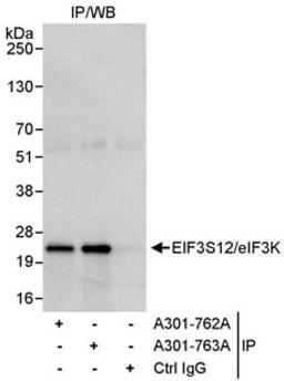 Detection of human eIF3K/EIF3S12 by immunoprecipitation.