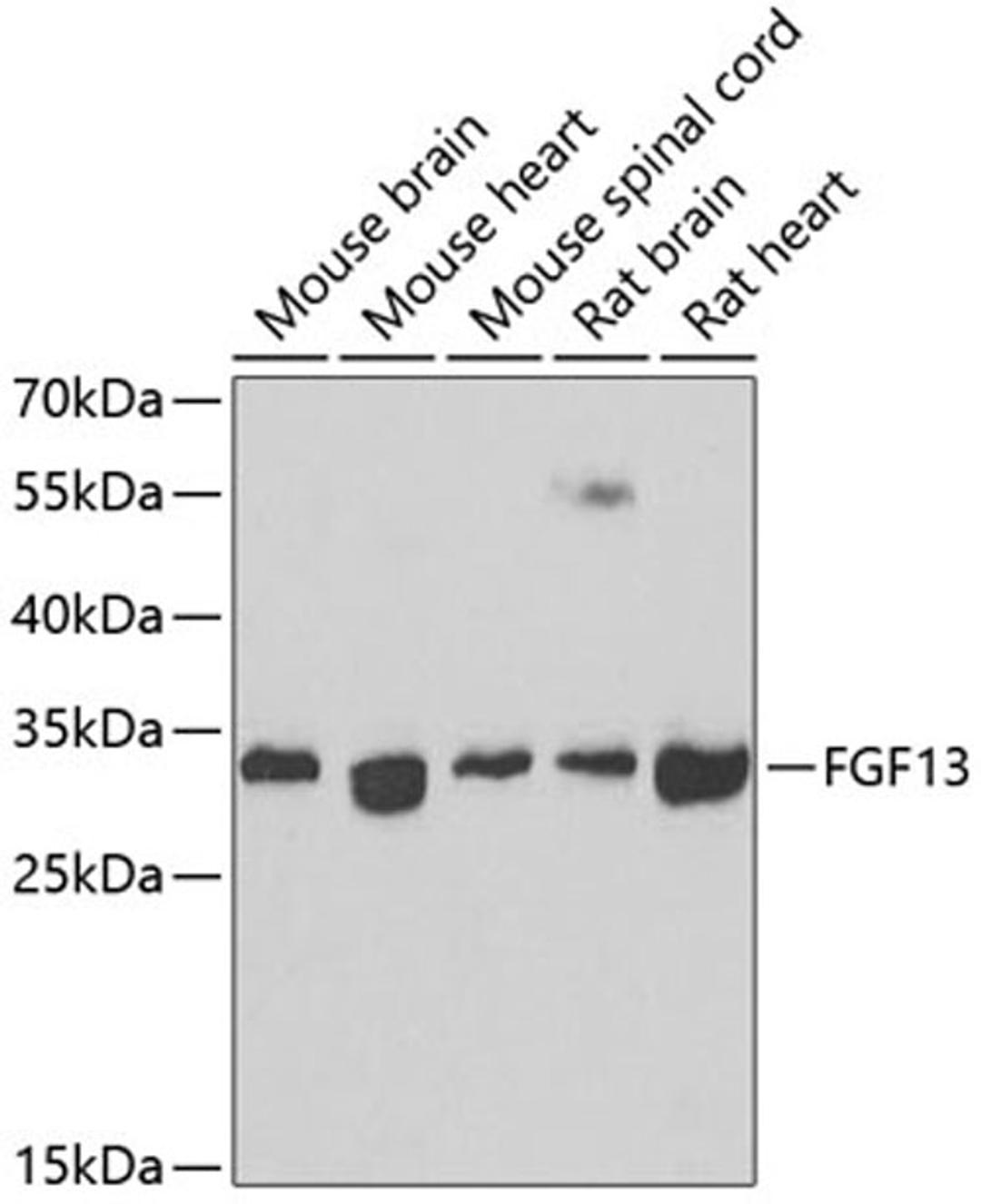 Western blot - FGF13 antibody (A7895)