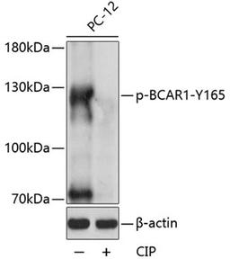 Western blot - Phospho-BCAR1-Y165 antibody (AP0813)