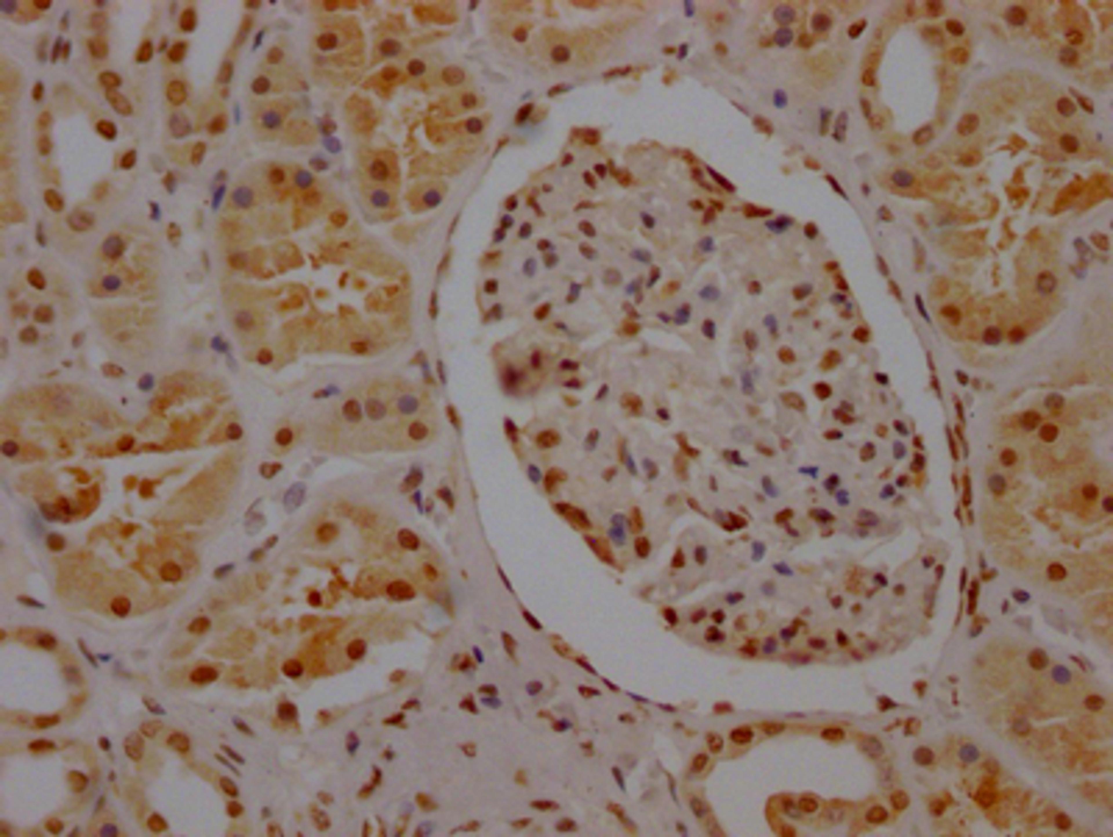 IHC image of CSB-RA984434A0HU diluted at 1:100 and staining in paraffin-embedded human kidney tissue performed on a Leica BondTM system. After dewaxing and hydration, antigen retrieval was mediated by high pressure in a citrate buffer (pH 6.0). Section was blocked with 10% normal goat serum 30min at RT. Then primary antibody (1% BSA) was incubated at 4℃ overnight. The primary is detected by a Goat anti-rabbit IgG polymer labeled by HRP and visualized using 0.05% DAB.
