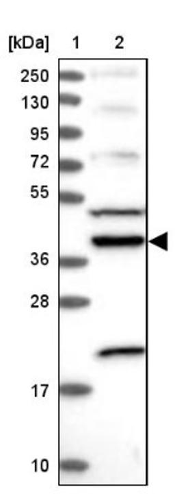 Western Blot: ARMC4 Antibody [NBP1-84175] - Lane 1: Marker [kDa] 250, 130, 95, 72, 55, 36, 28, 17, 10<br/>Lane 2: Human cell line RT-4