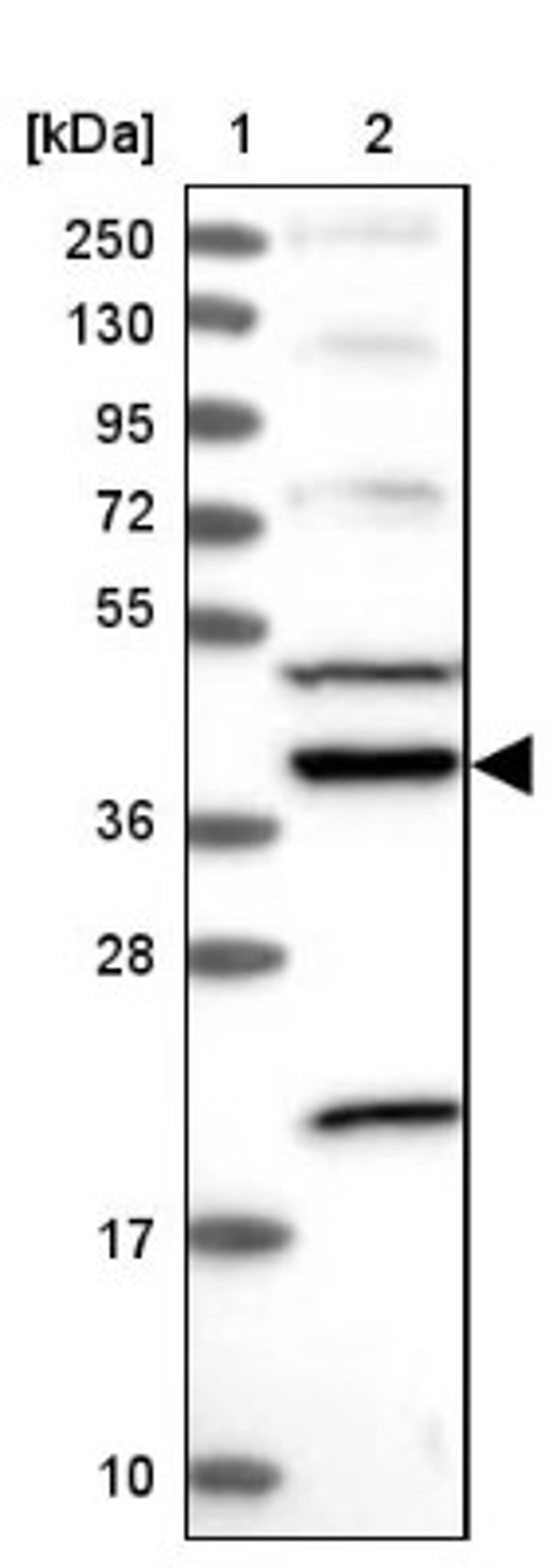 Western Blot: ARMC4 Antibody [NBP1-84175] - Lane 1: Marker [kDa] 250, 130, 95, 72, 55, 36, 28, 17, 10<br/>Lane 2: Human cell line RT-4