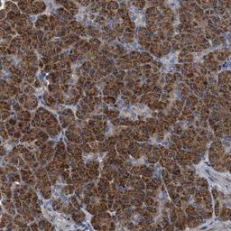 Immunohistochemistry-Paraffin: TEX2 Antibody [NBP1-83156] - Staining of human pancreas shows strong cytoplasmic positivity in exocrine cells.