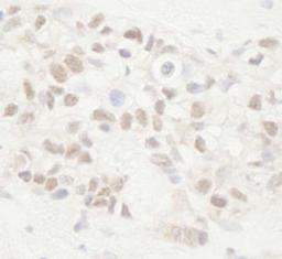 Detection of human APC by immunohistochemistry.