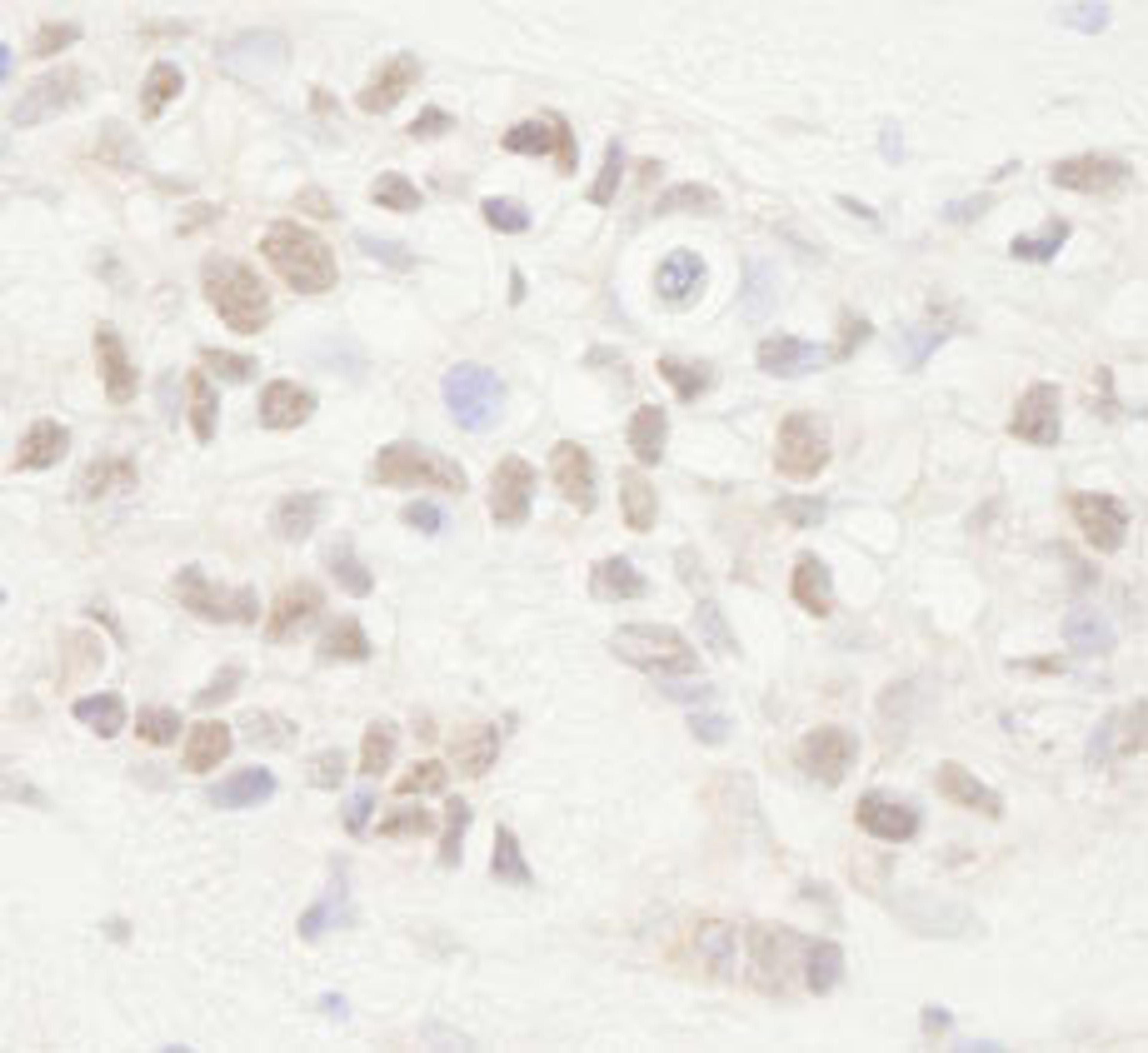 Detection of human APC by immunohistochemistry.