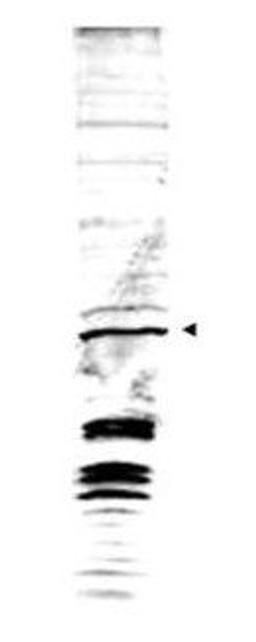 Western blot analysis of detect endogenous protein present in S.pombe lysate (arrowhead) using Swi6 antibody