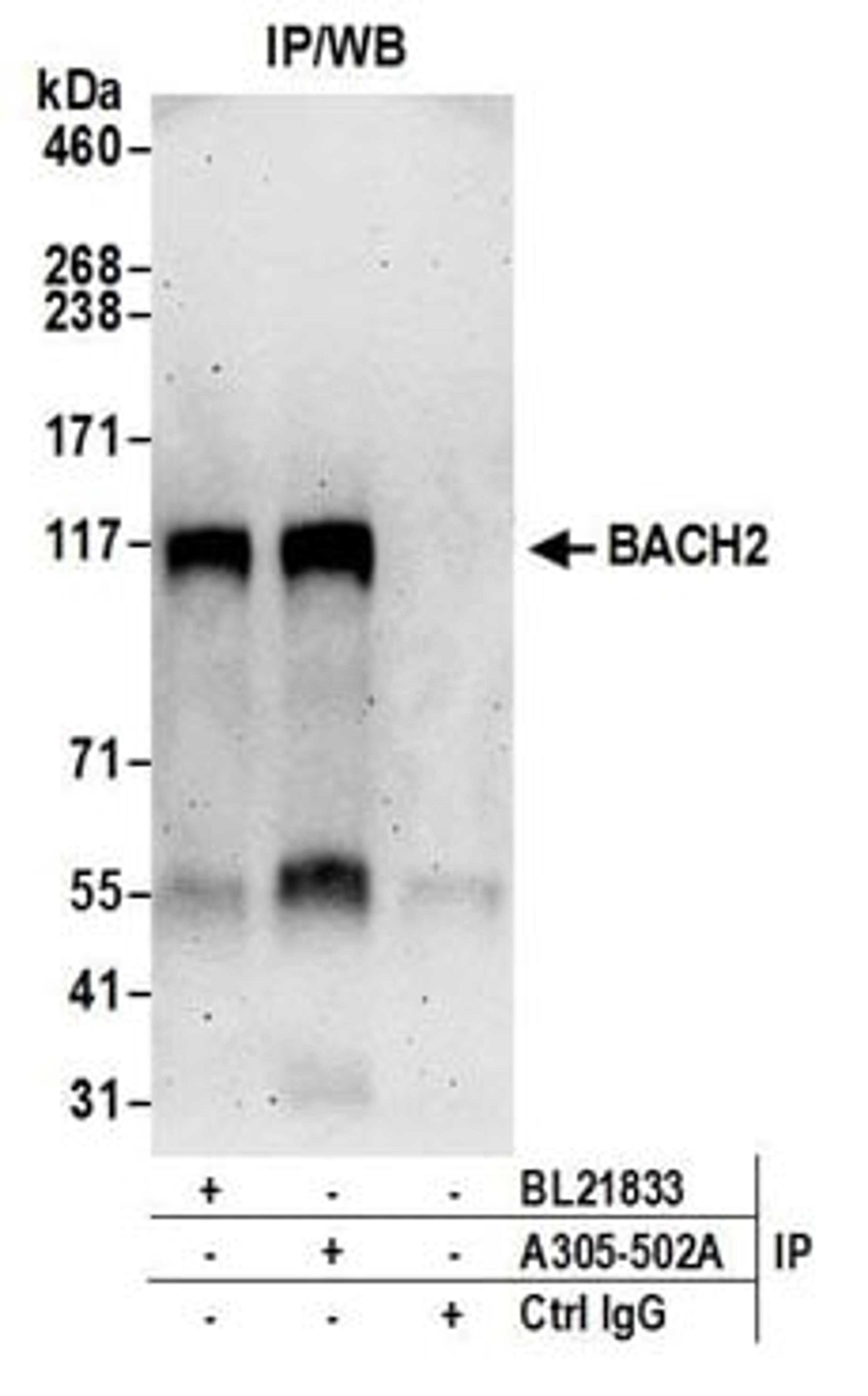 Detection of human BACH2 by western blot of immunoprecipitates.