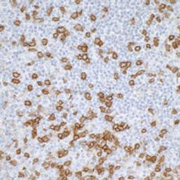 Detection of human CD45RO by immunohistochemistry.