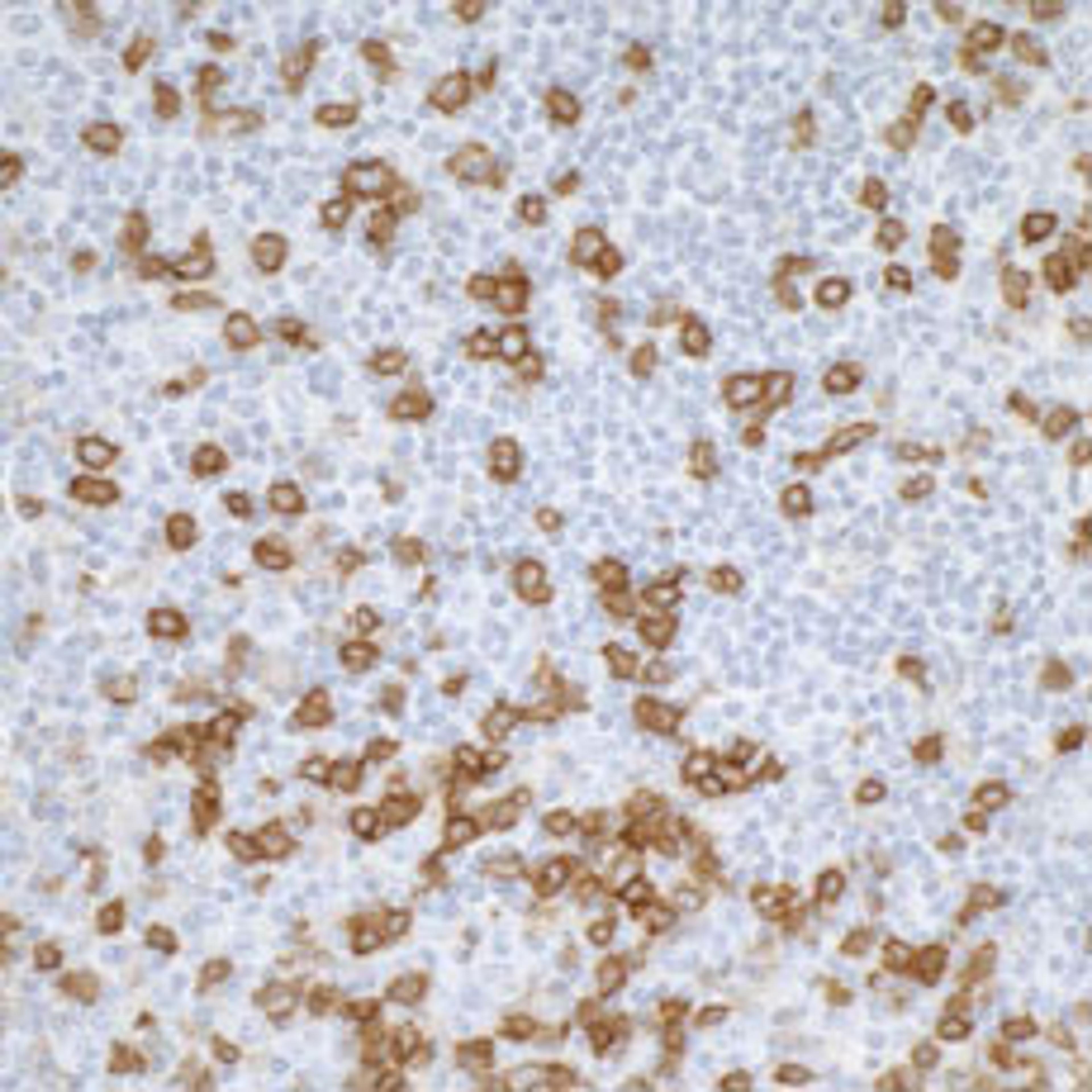 Detection of human CD45RO by immunohistochemistry.