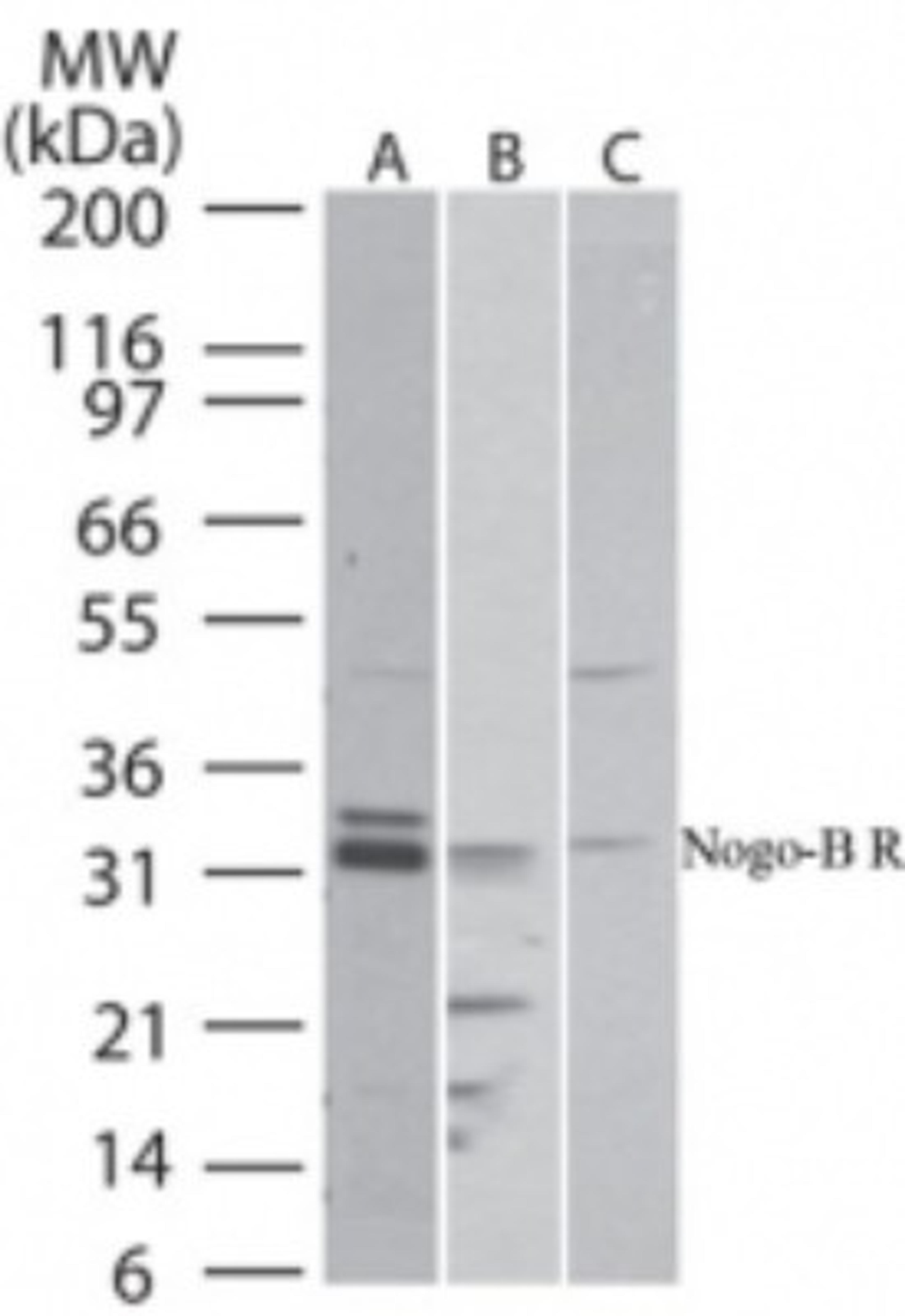 Western Blot: Nogo B receptor Antibody [NBP2-24950] - Western blot analysis of Nogo-Breceptor in A) human, B) mouse and C) rat brain tissue lysate using NBP2-24950 at 2ug/ml.