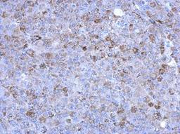 Immunohistochemistry-Paraffin: SLC25A15 Antibody [NBP2-20387] - Hela xenograft, using antibody at 1:500 dilution.