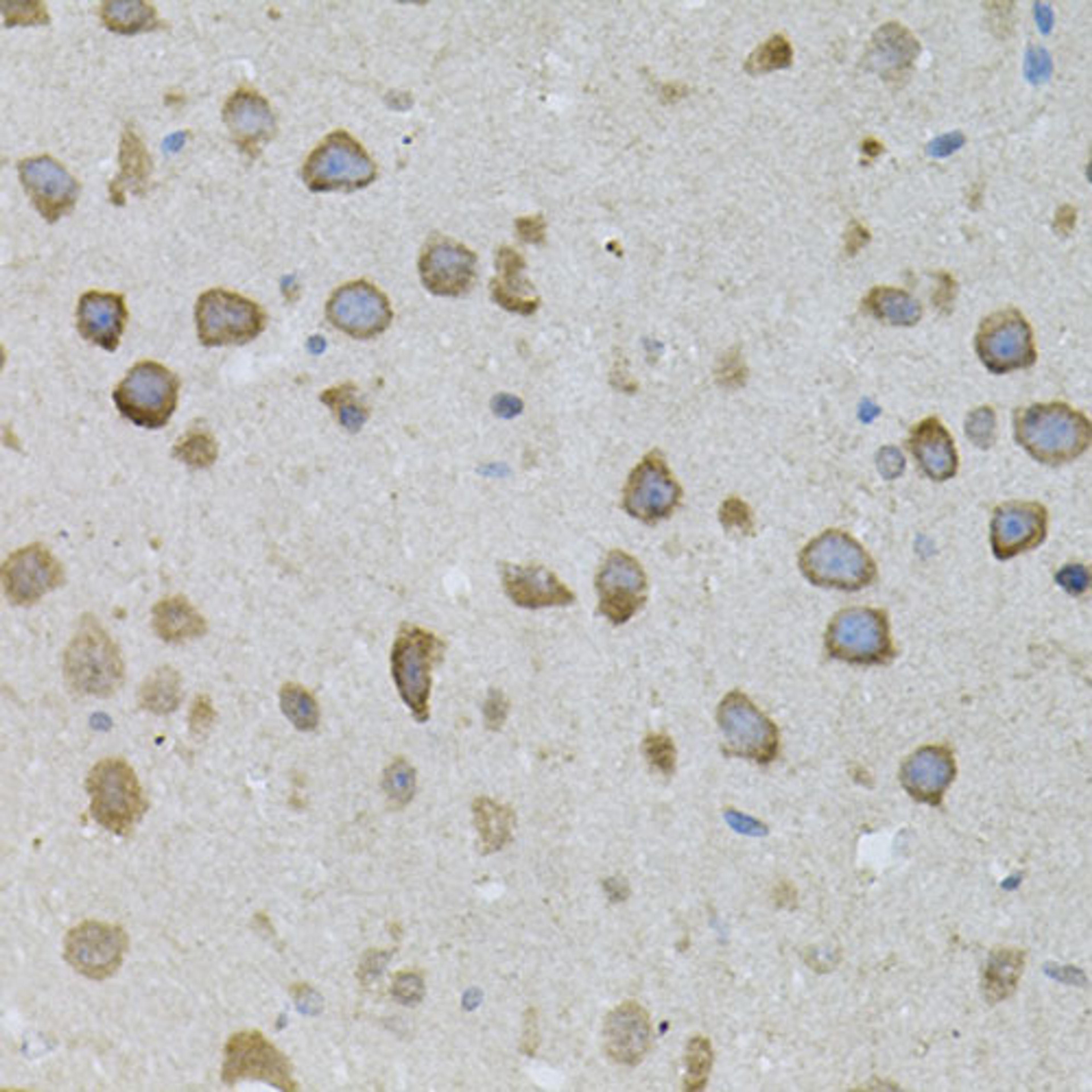 Immunohistochemistry  - ASAH2 antibody (A7985)