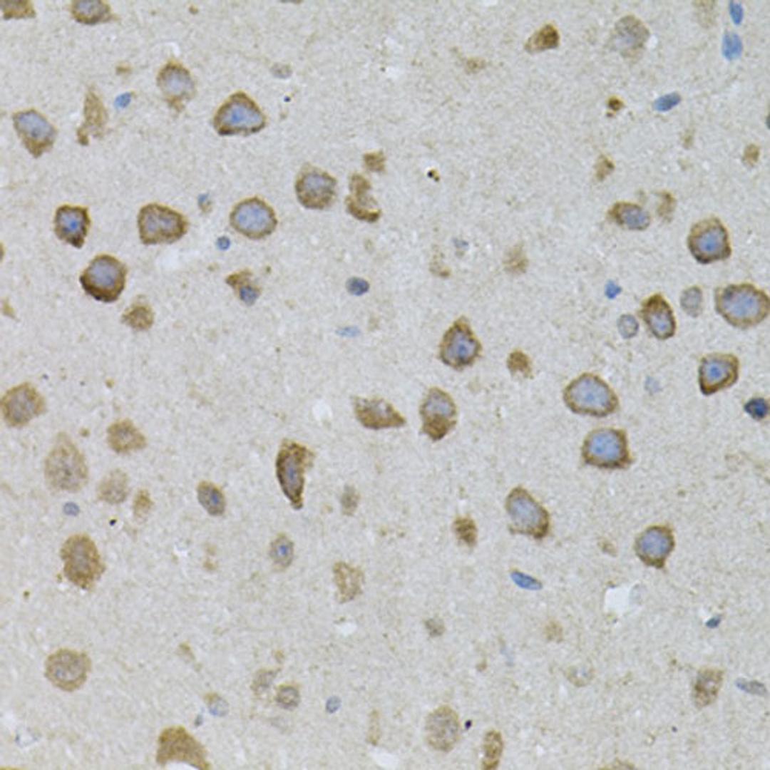 Immunohistochemistry - ASAH2 antibody (A7985)