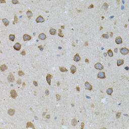 Immunohistochemistry - ASAH2 antibody (A7985)