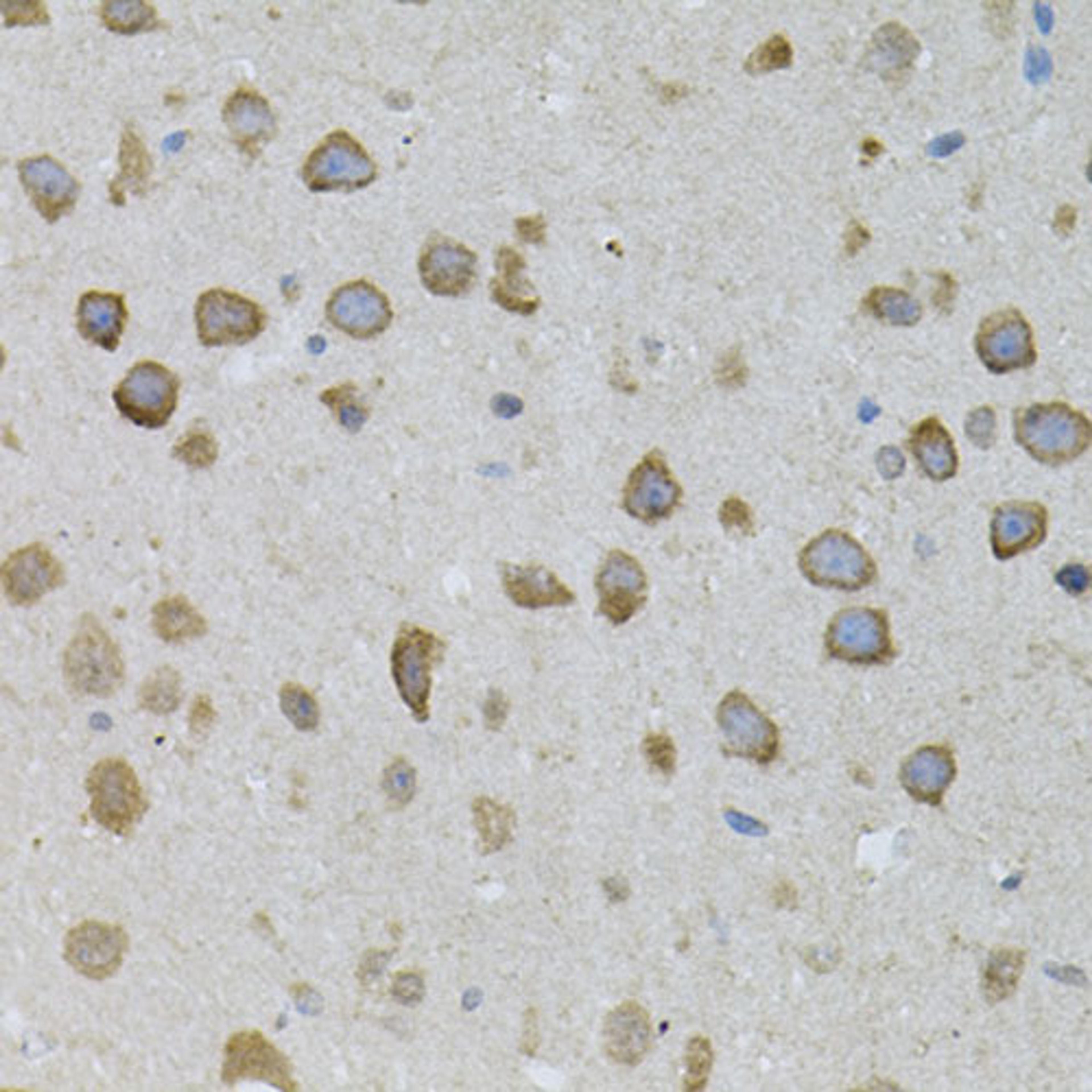 Immunohistochemistry - ASAH2 antibody (A7985)