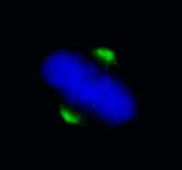 Detection of human ASPM by immunocytochemistry.