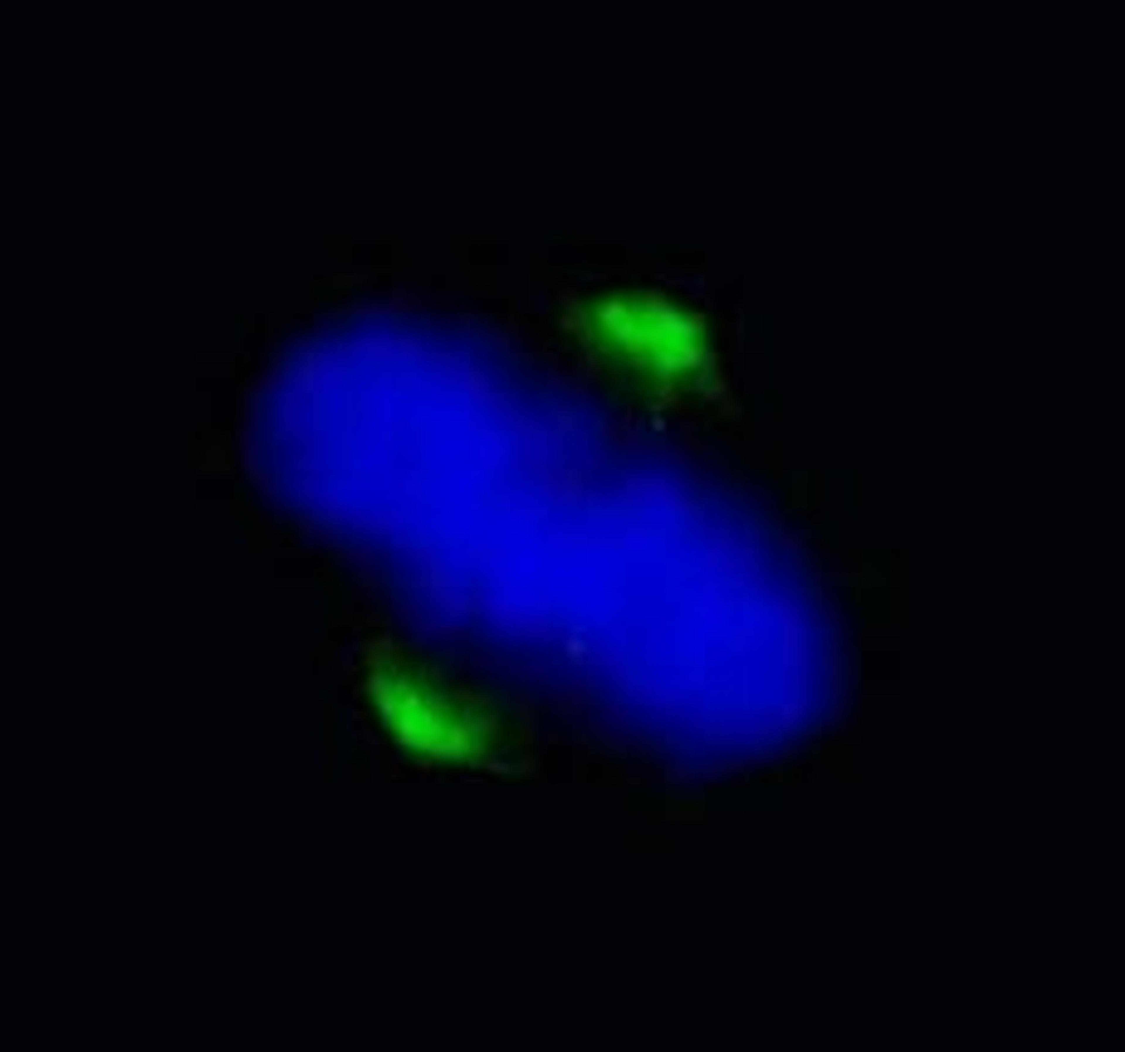 Detection of human ASPM by immunocytochemistry.