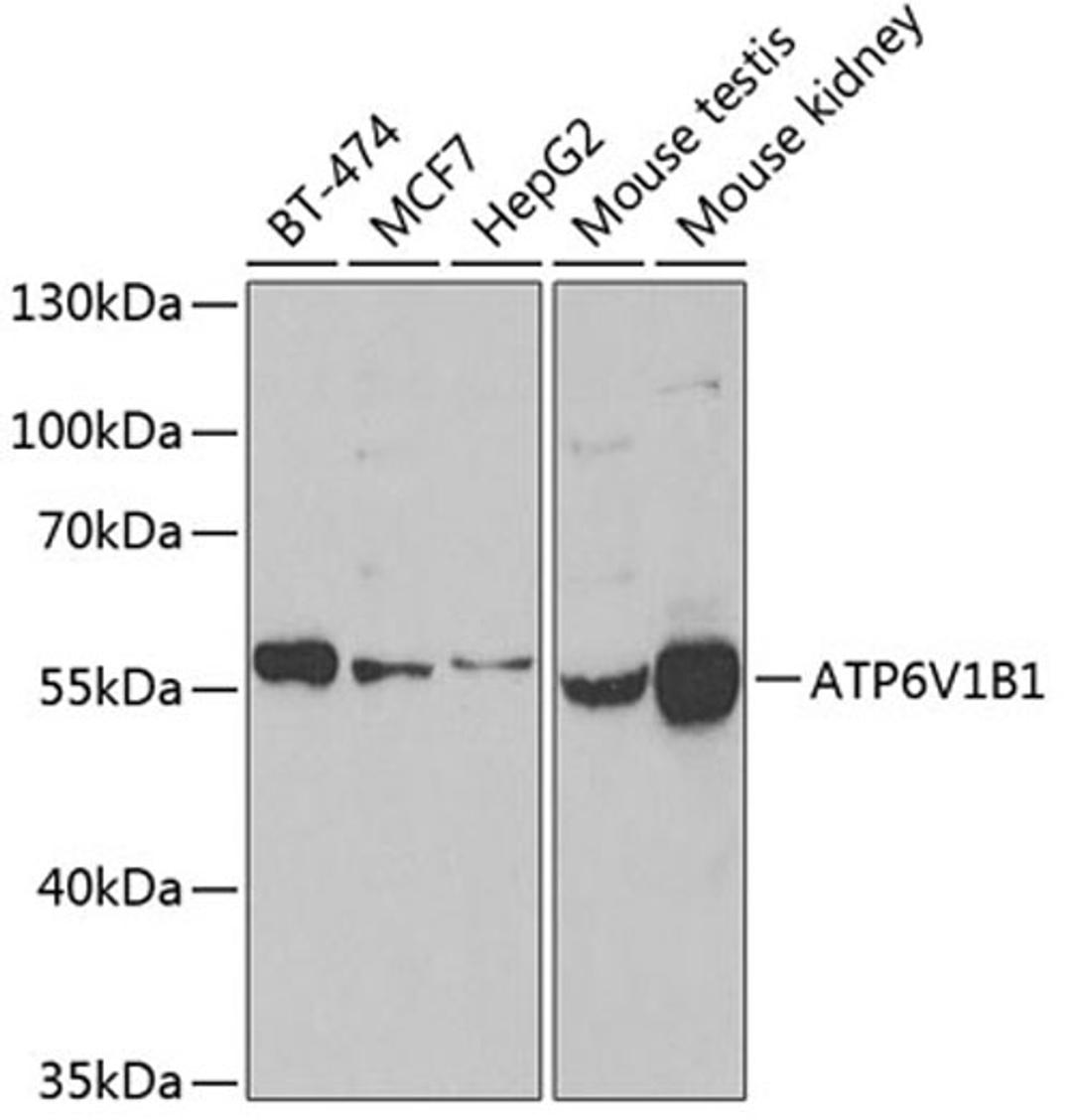 Western blot - ATP6V1B1 antibody (A6876)